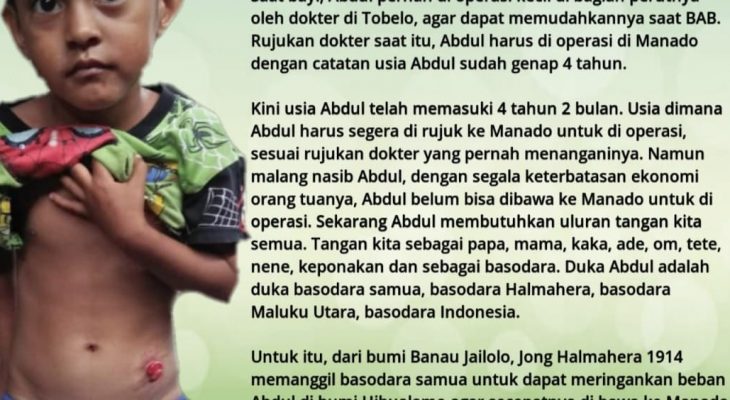 Jong Halmahera 1914 Galang Dana Bantu Anak Penderita Atresia Ani di Tobelo