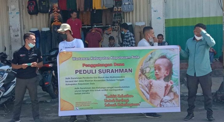 Peduli Balita Penderita Gizi Buruk Dan Hidrocyfalus, Ini Yang Dilakukan Wartawan