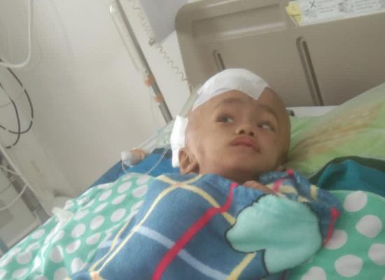 Dinkes Kepsul Beri Perhatian Khusus Kasus Gizi Buruk